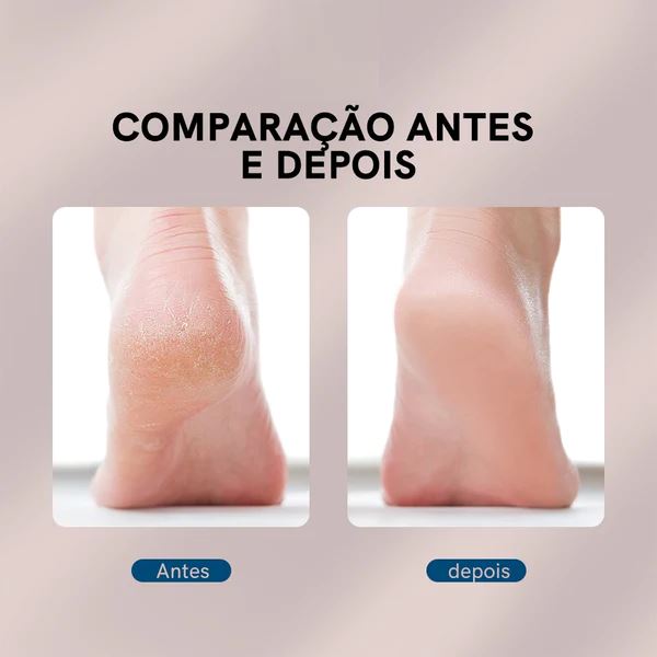 Lixa Elétrica contra rachaduras e pele seca - BeautyFeet©️